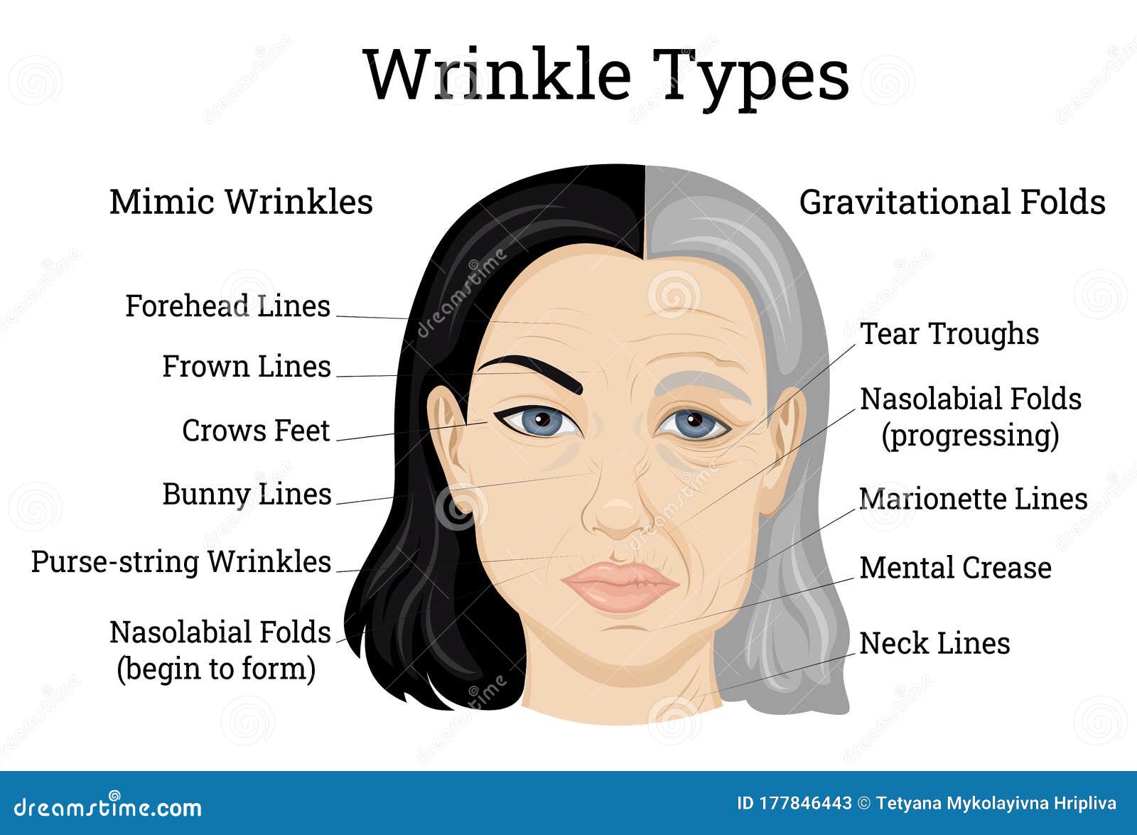 Facial Lines And Wrinkles Telegraph facial-lines-and-wrinkles-telegraph