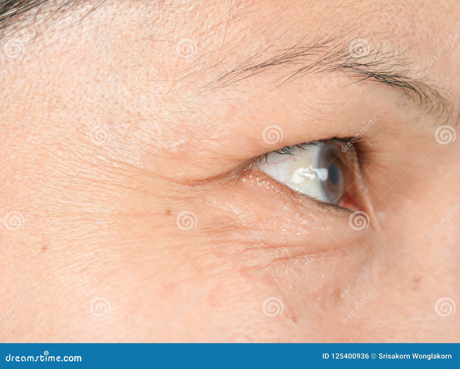 Wrinkles on the eyes stock photo. Image of circles, wrinkle 125400936