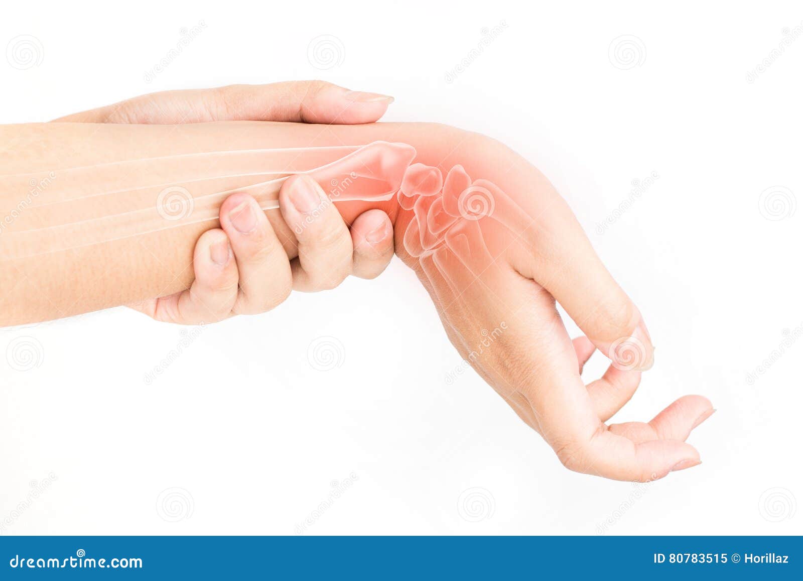 Wrist bones injury stock image. Image of numbness, hand 80783515