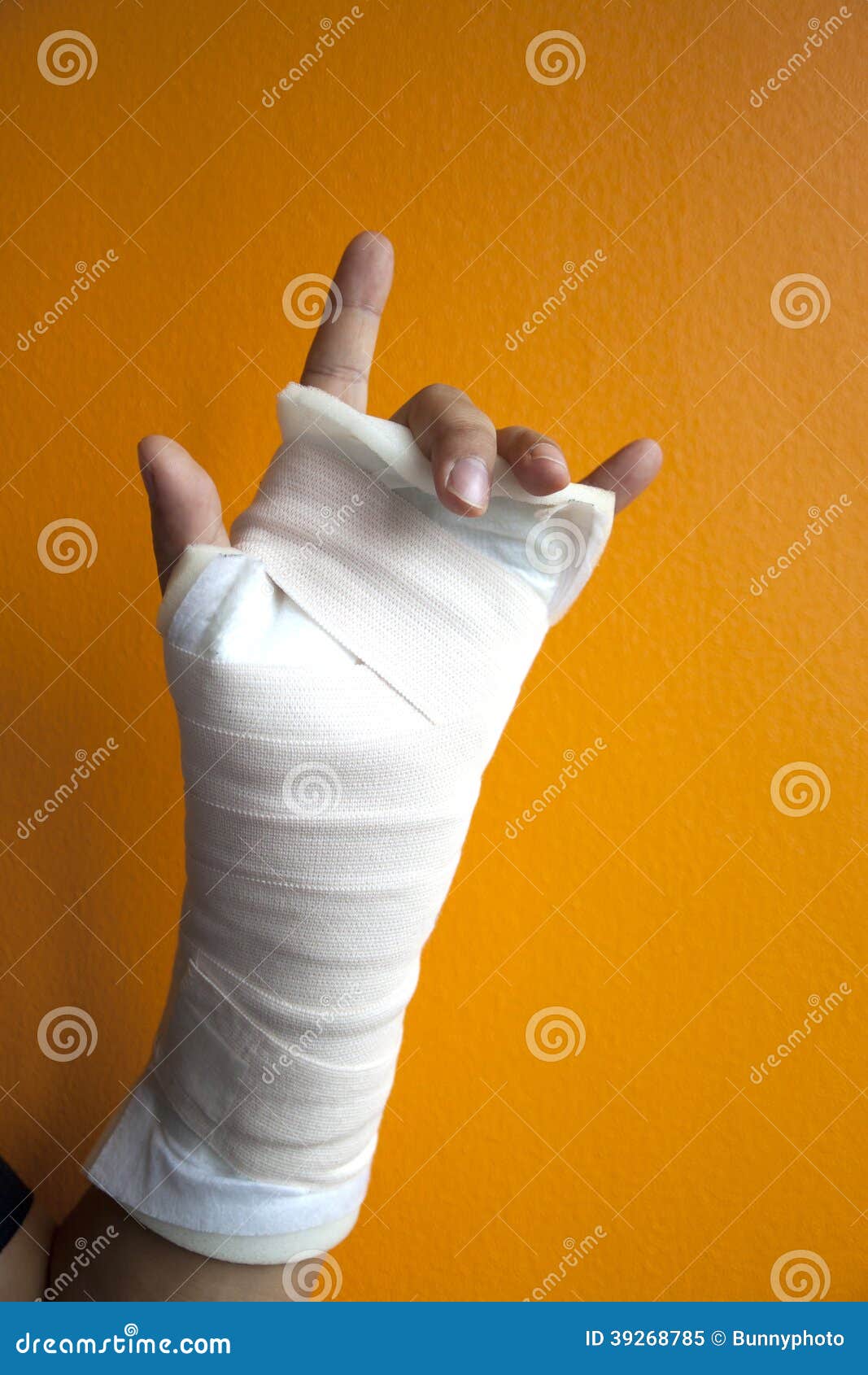 Wrist injury with splint stock image. Image of orange 39268785