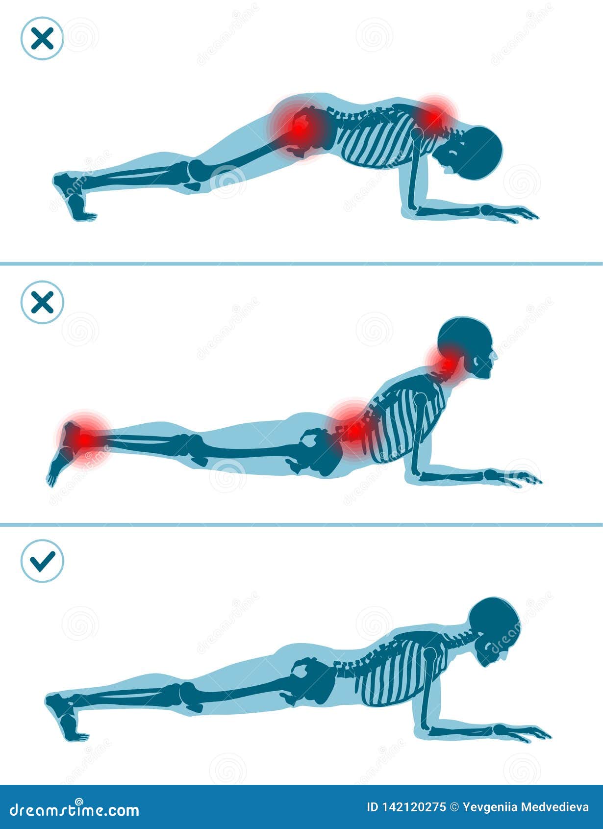 Plank | Illustrated Exercise Guide