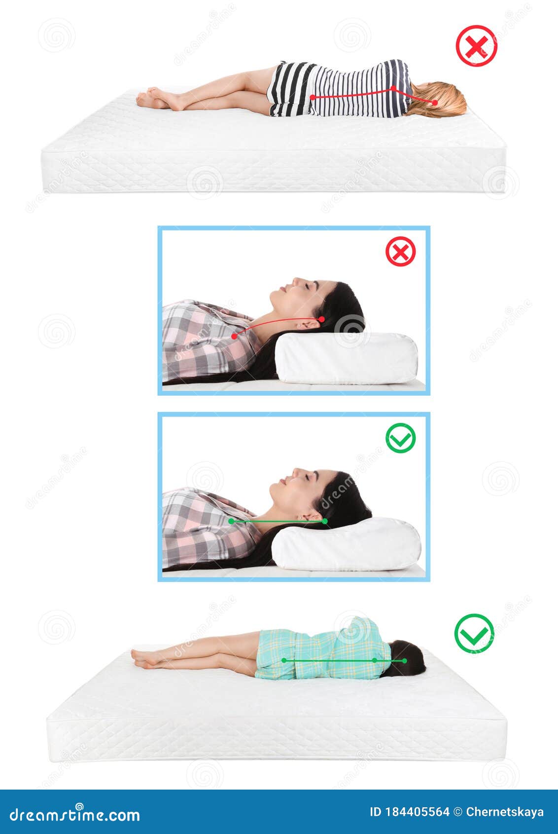 Wrong and Correct Sleeping Posture. Choose Right Pillow and Mattress Stock Photo Image of healthy female 184405564