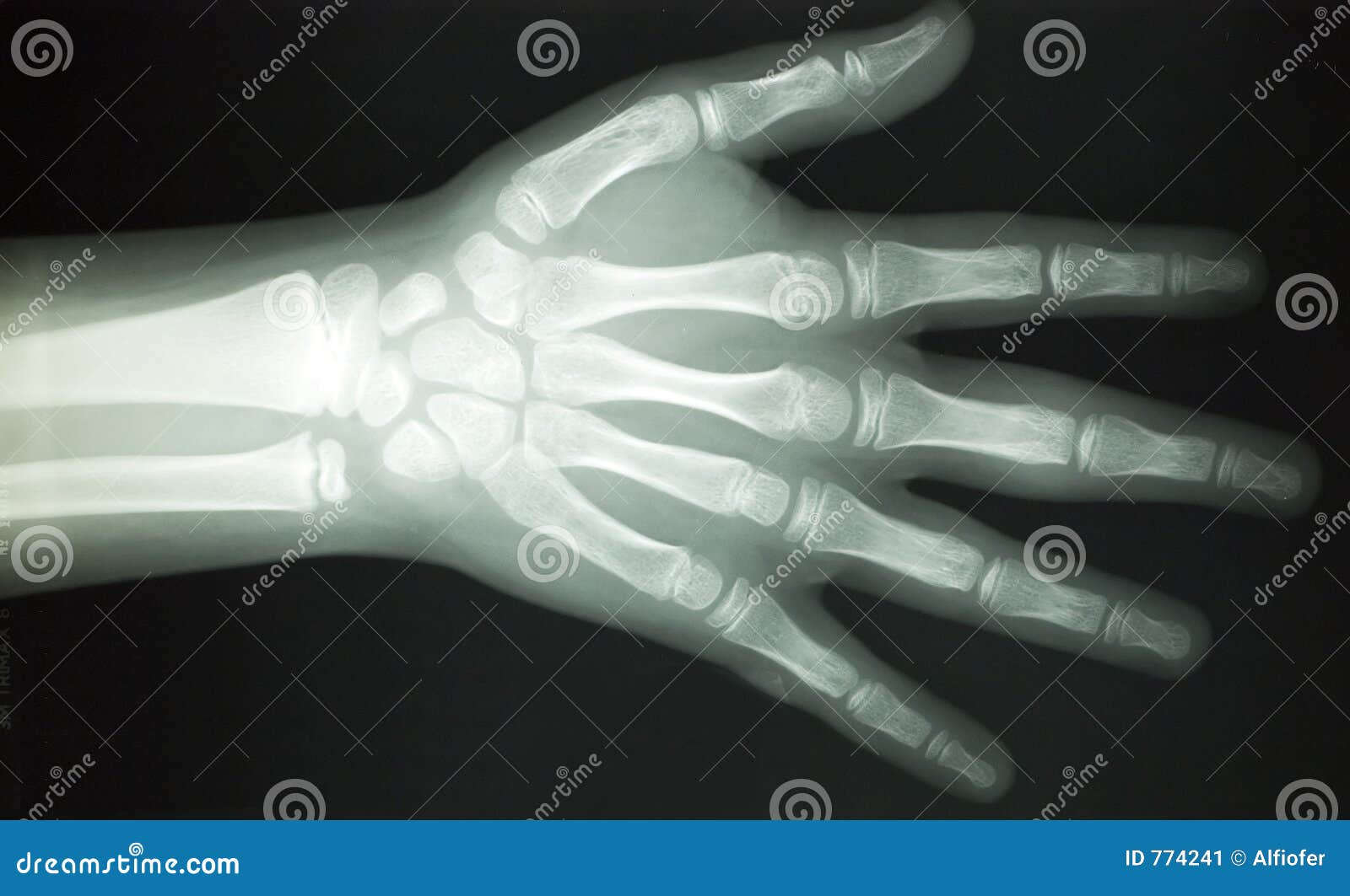 X RAY BODY PARTS Stock Image Image 774241