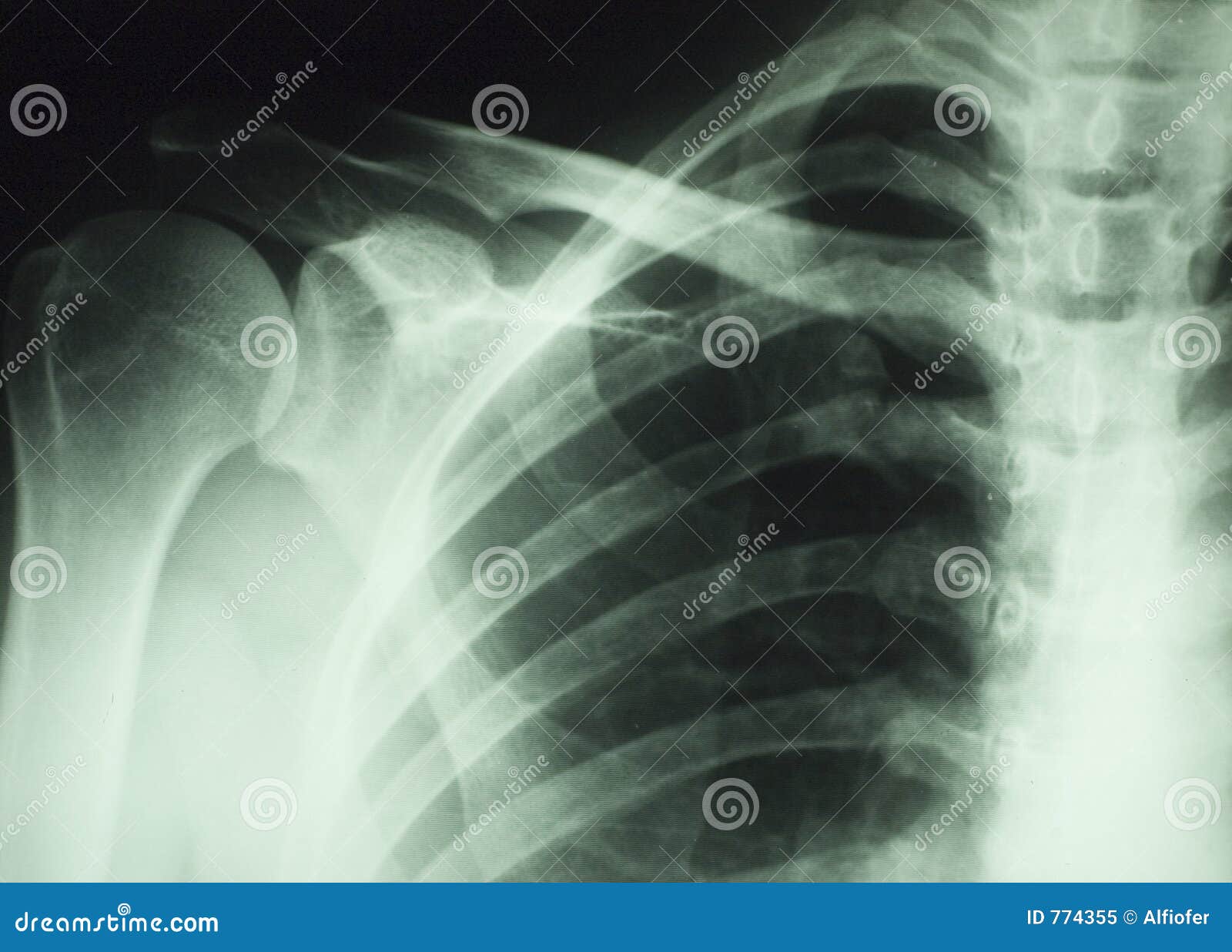 x ray body parts