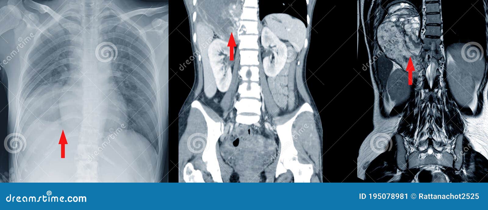 izen imaging mri ct scan usg xray interventions