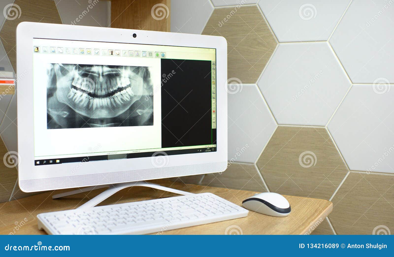 1.17 x ray download 1.17 x ray download