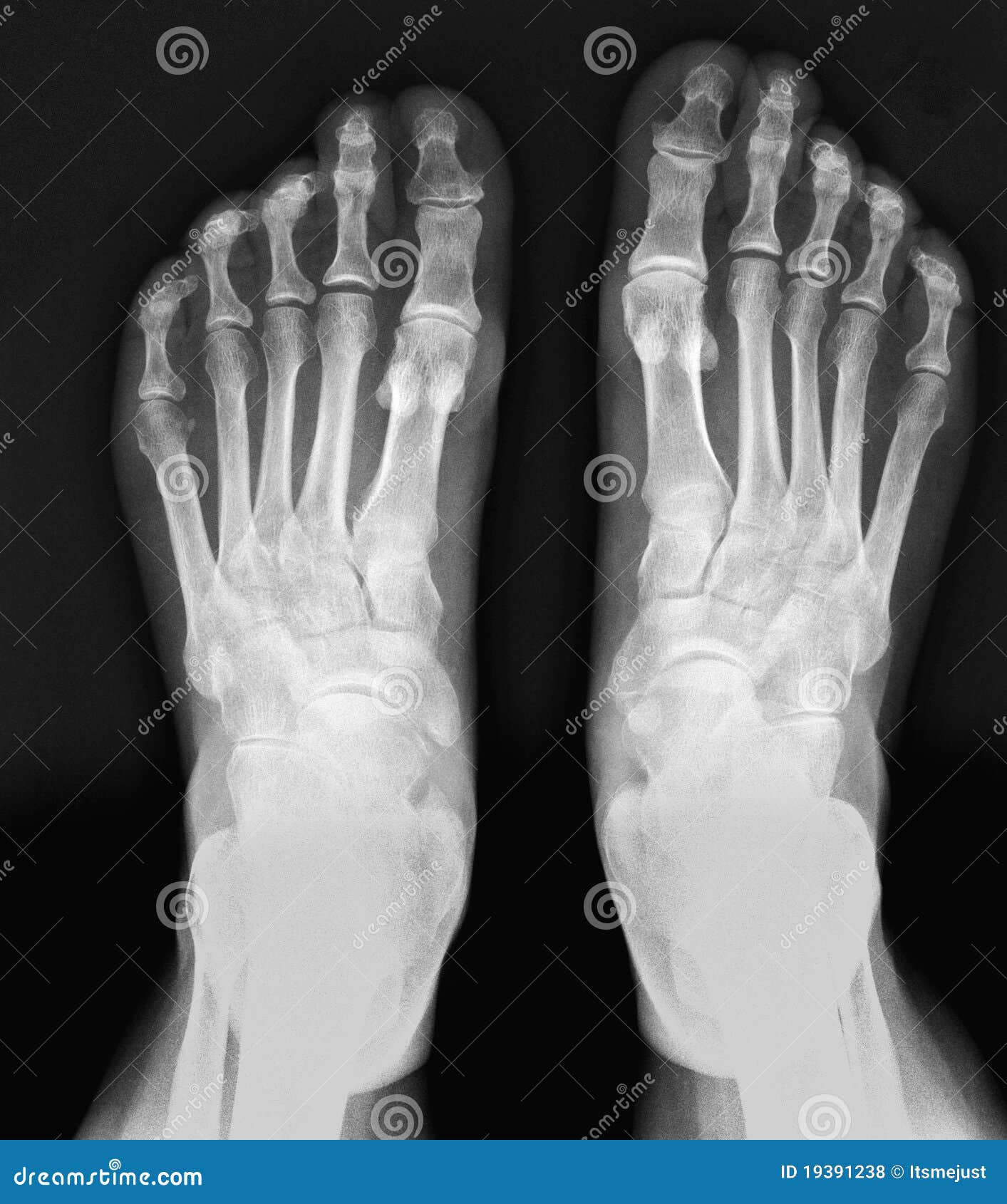Download X-ray Feet. Royalty Free Stock Photos - Image: 19391238
