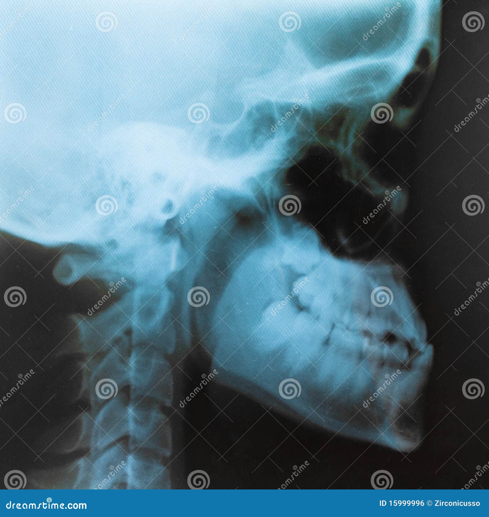 XRay Film Royalty Free Stock Image Image 15999996