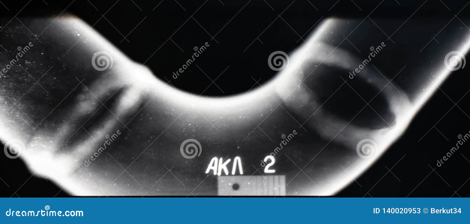 X-ray of a Welded Seam of the Pipeline Stock Image - Image of deficiency,  pipeline: 140020953