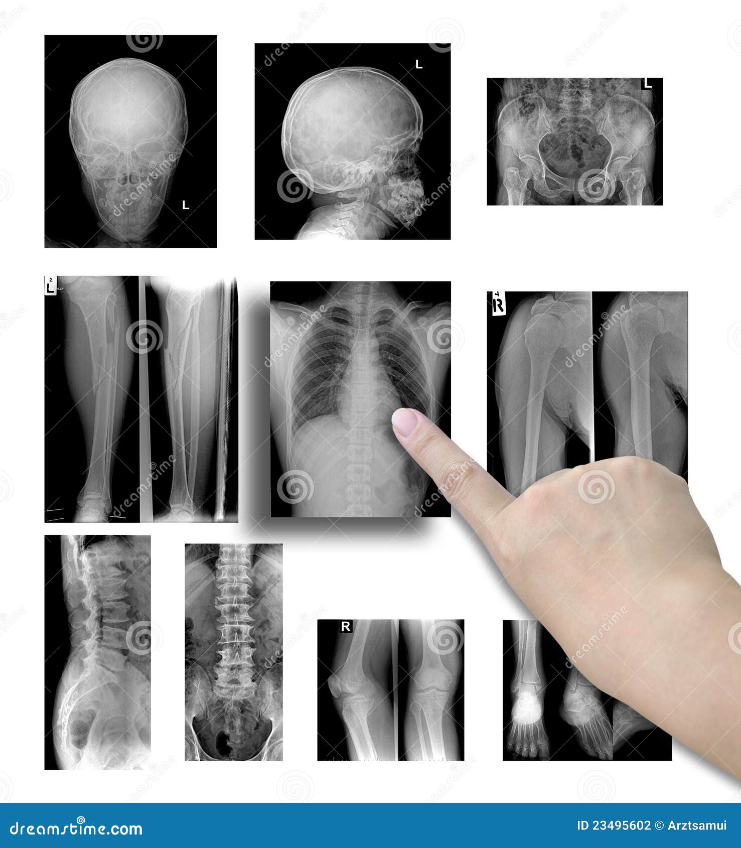 X ray films stock photo. Image of care, computer, lung 23495602