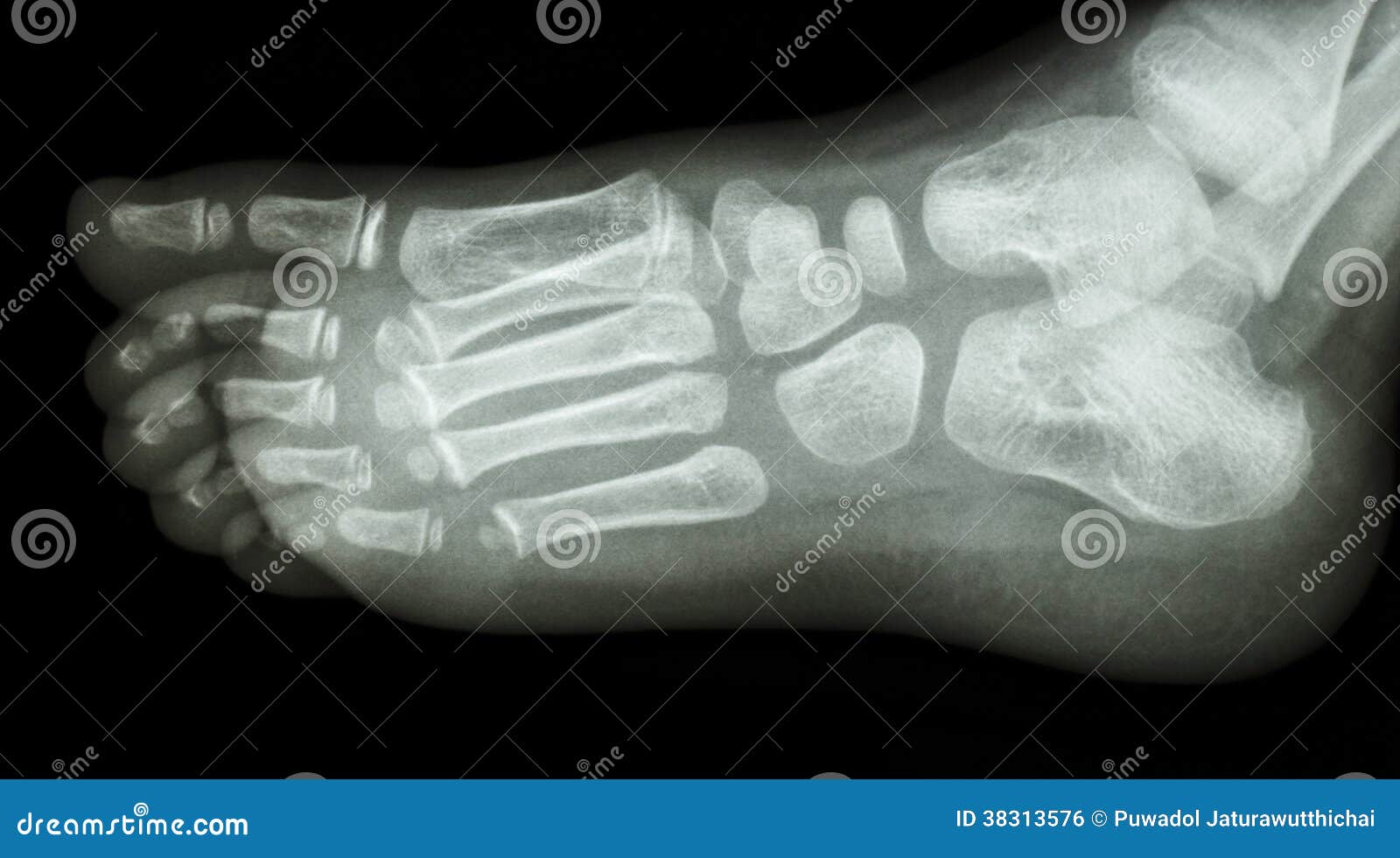 royalty free stock image x ray foot lateral show normal child s foot image38313576