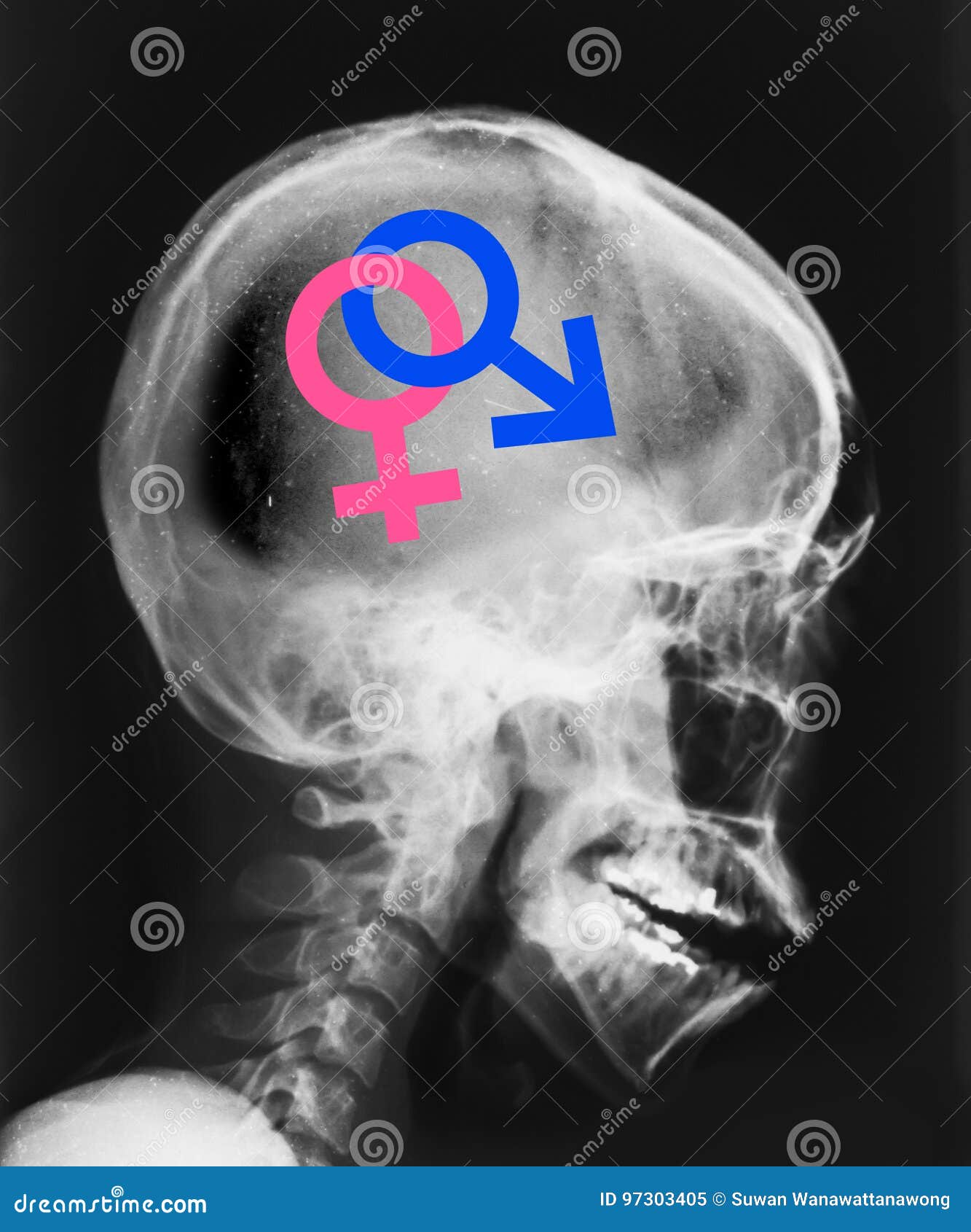 X-ray of Head Isolated and Symbol Sex Inside. Stock Image - Image of radiogram, strain: 97303405