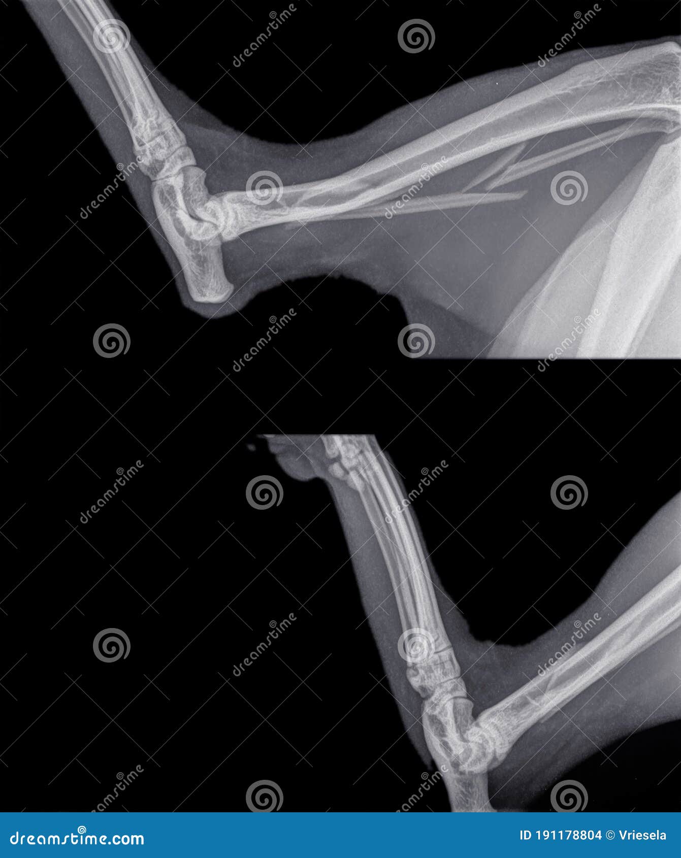 X Ray Of The Hind Leg Of A Cat With A Fracture Of The Calf Bone Fibula