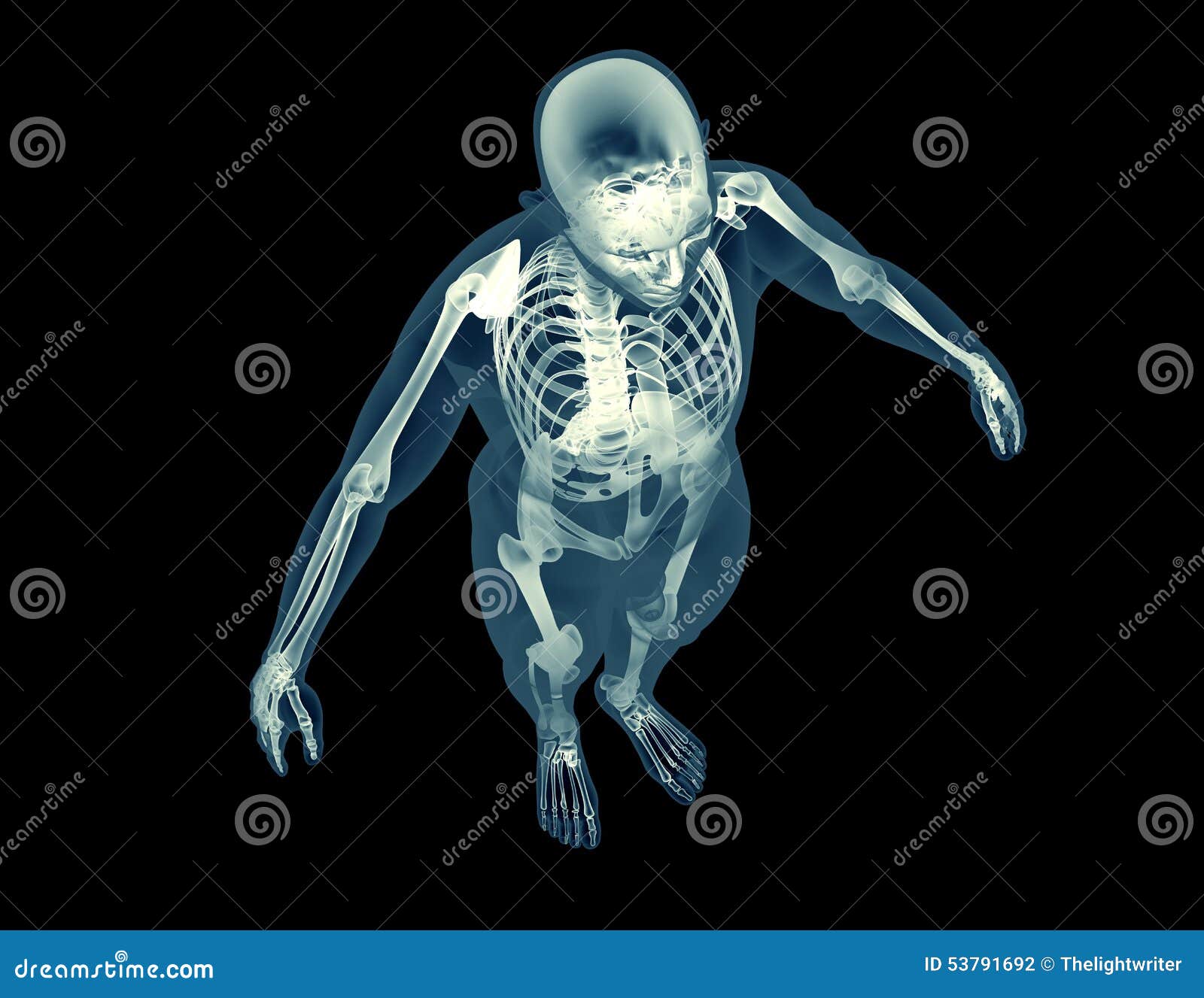 Xray Image of a Human Body Stock Illustration Illustration of bone