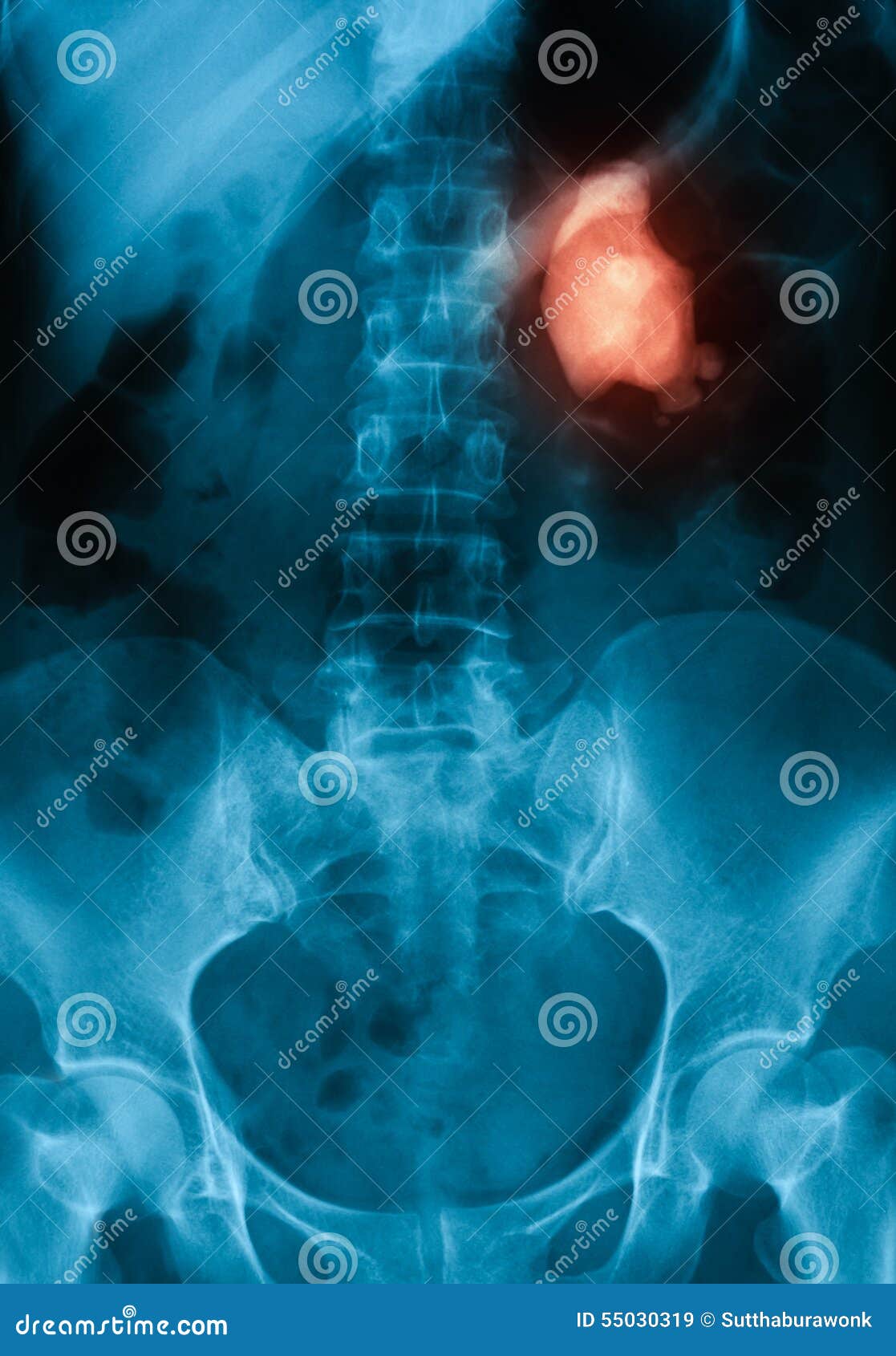 242 Supine View Stock Photos - Free & Royalty-Free Stock Photos from  Dreamstime