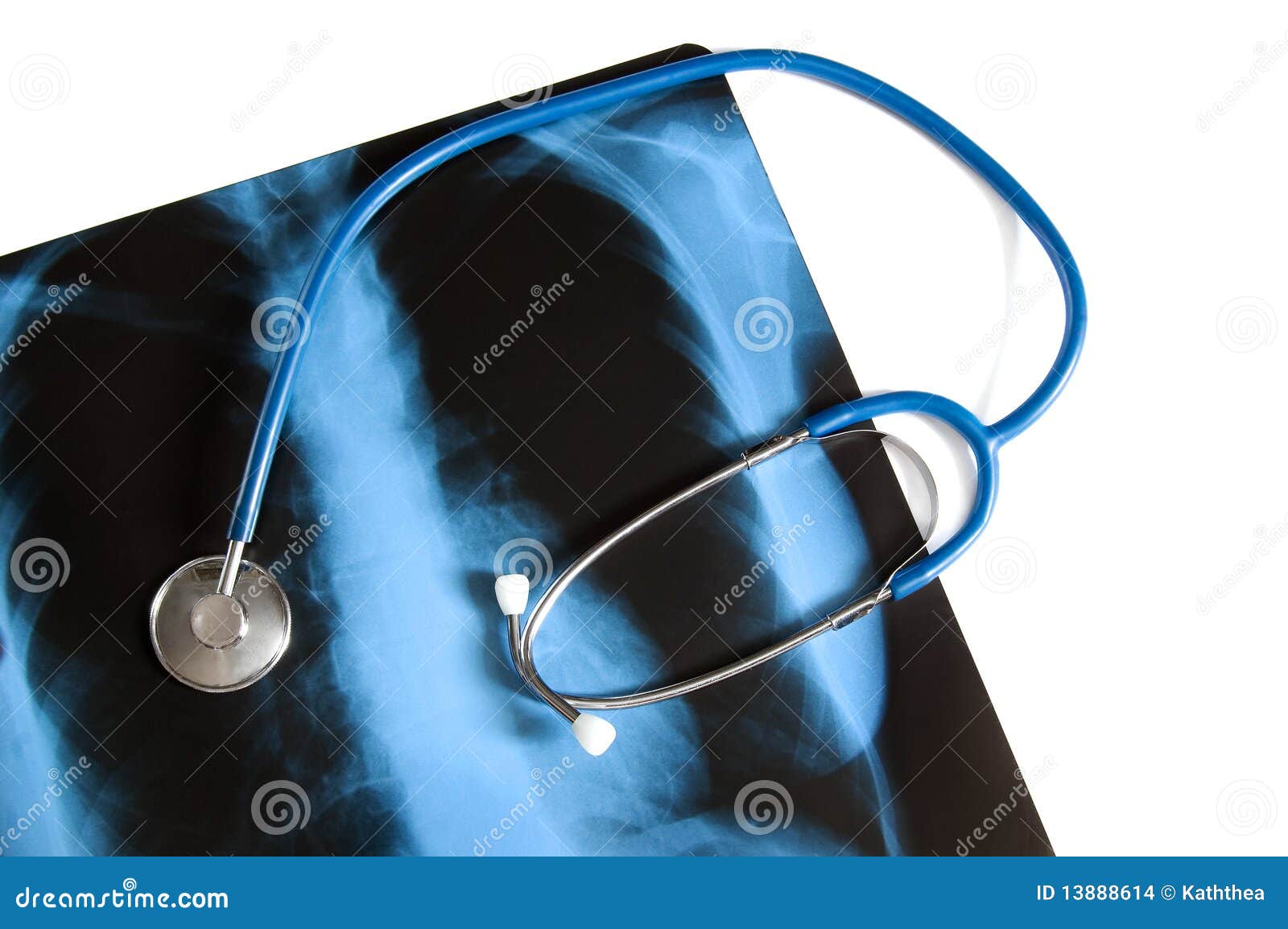 Xray Of Lungs And Stethoscope Stock Photo Image 13888614