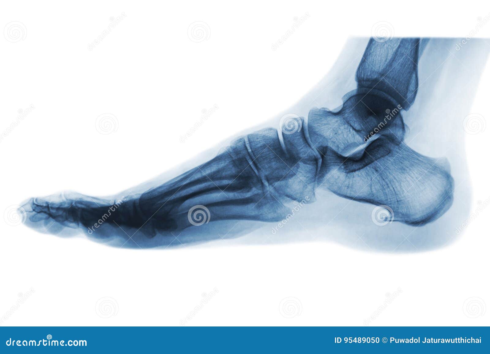 x-ray normal human foot . lateral view .invert color style .