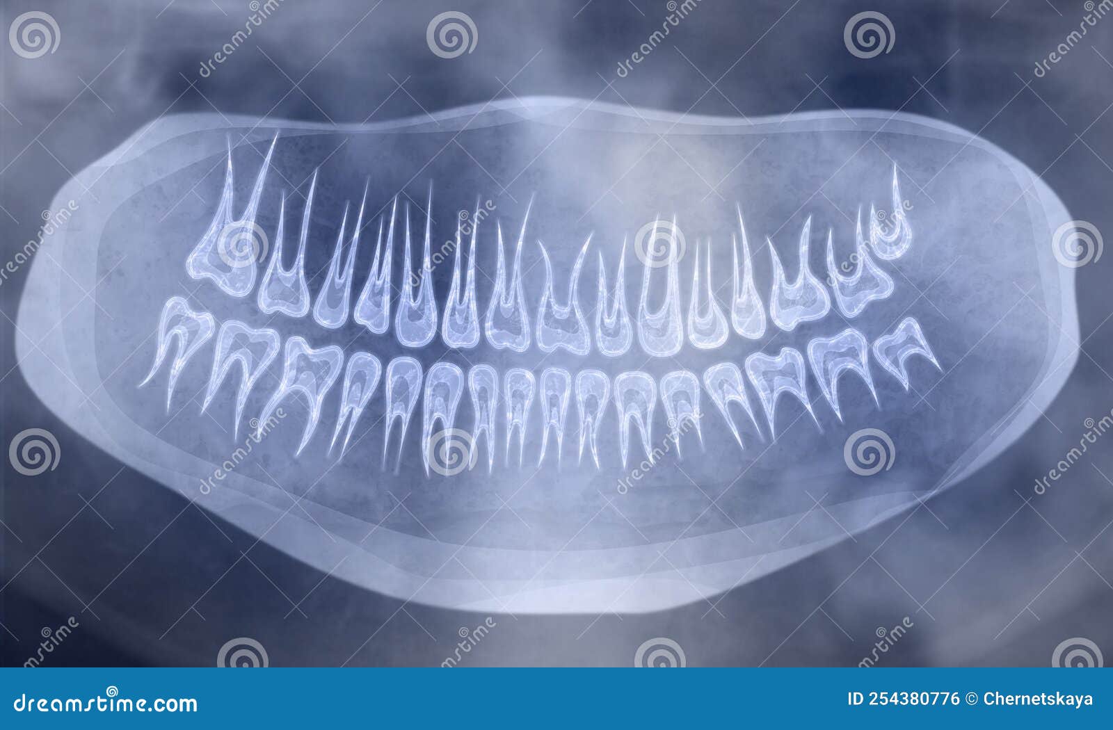 Xray Picture of Oral Cavity with Teeth Stock Photo Image of dentist, human 254380776