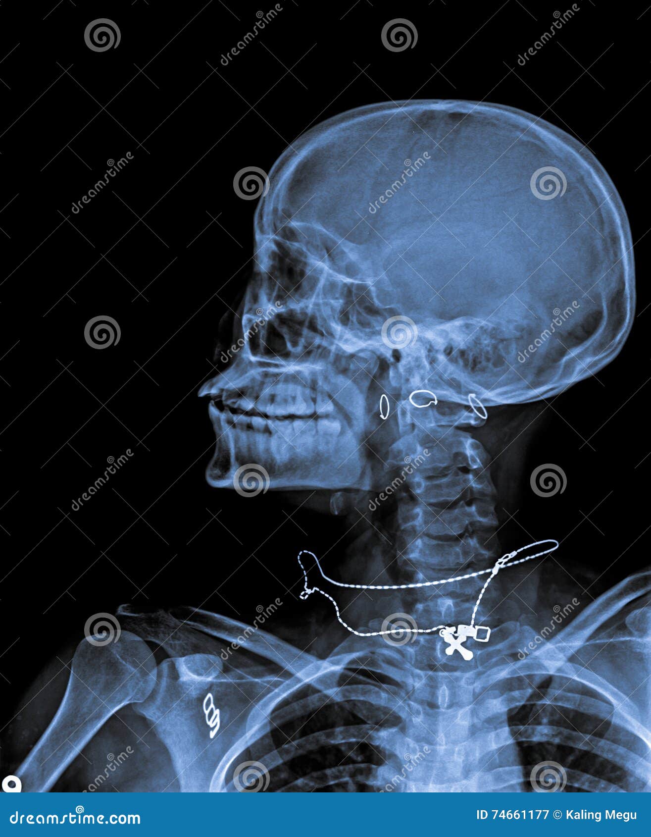 X Ray Ear Anatomy Stock Photos Free & RoyaltyFree Stock Photos from