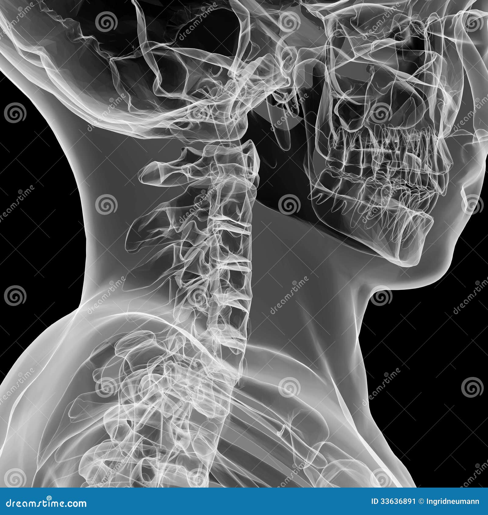 X-ray View Of Human Cervical Spine Stock Image - Image: 33636891