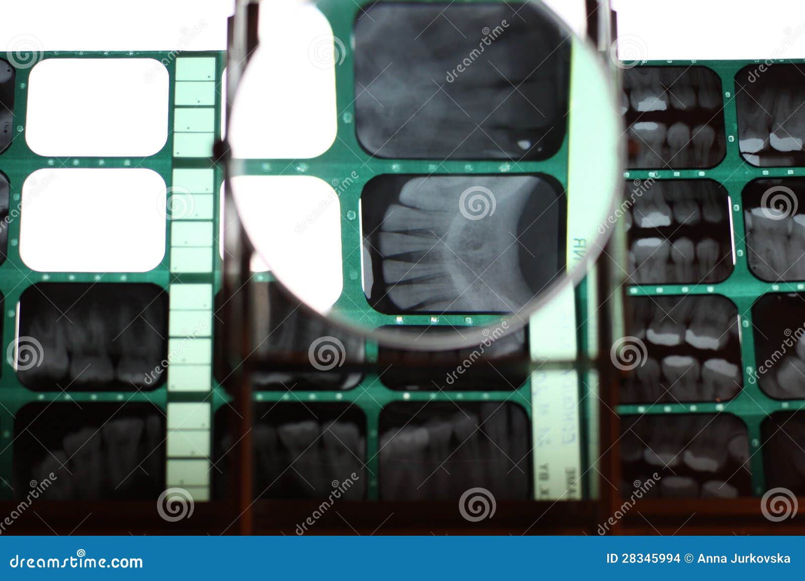 Xrays in dentistry stock photo. Image of occlusion, structure 28345994