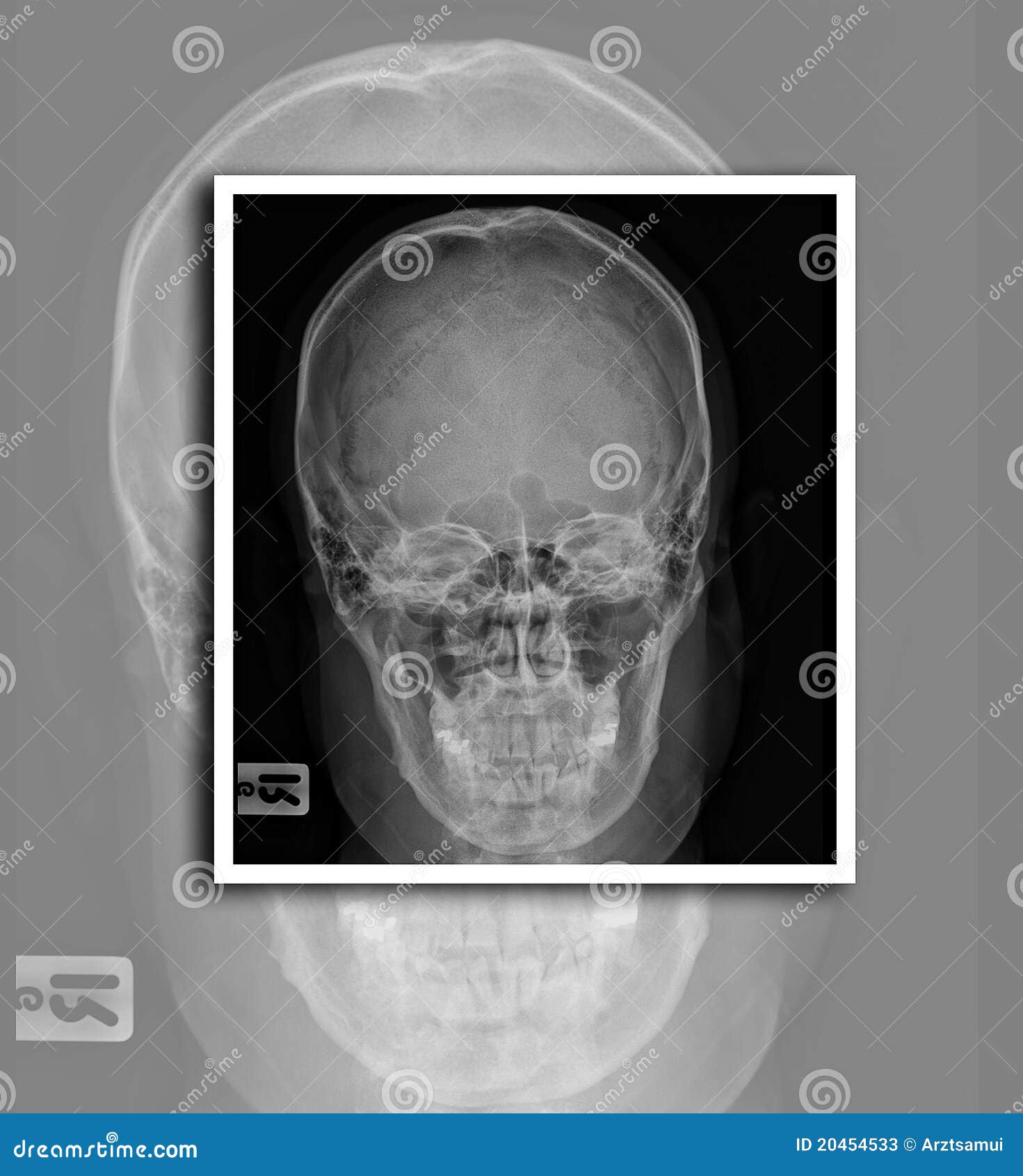 Xray film stock image. Image of color, backdrop, beauty 20454533