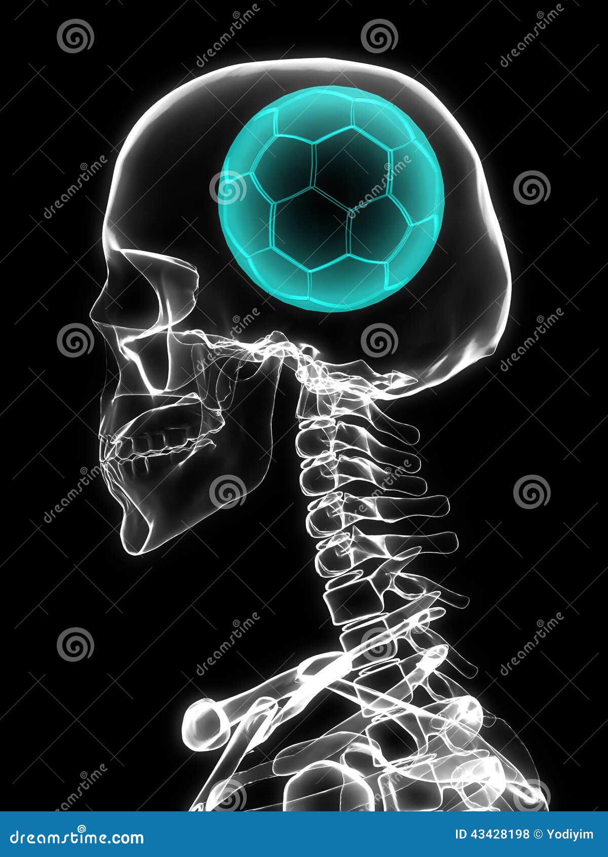 Xray Of Skull With Soccer Ball. Stock Photo Image 43428198