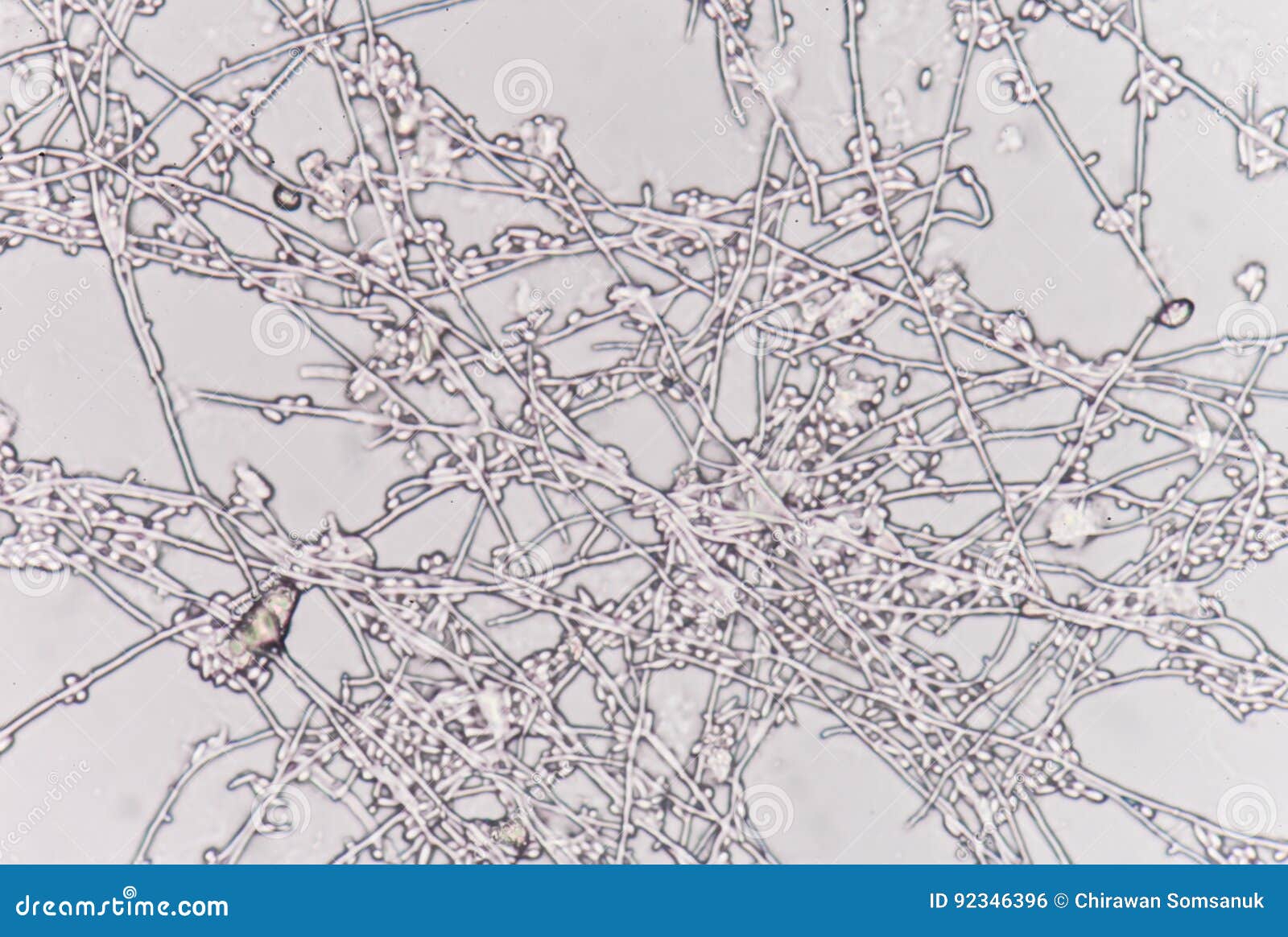 Yeast Cells in Urine Sample. Stock Photo Image of saccharomyces
