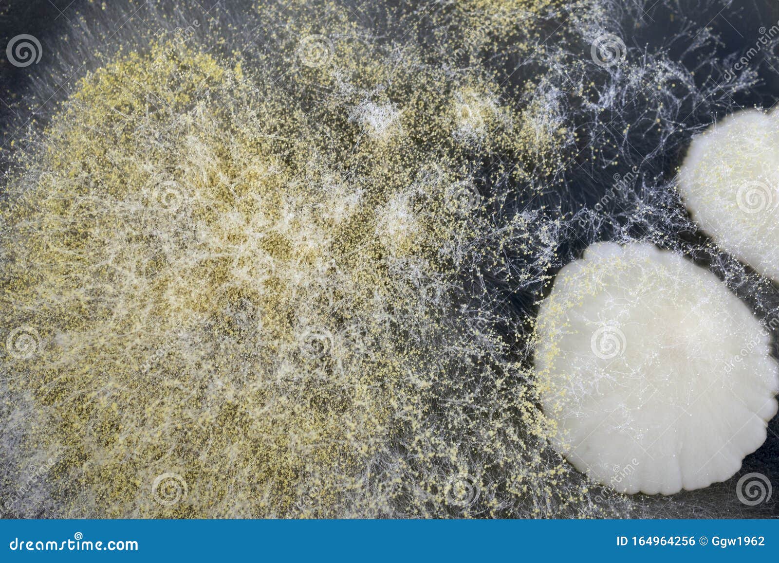 Yeast and mold stock photo. Image of morphology, inspection - 164964256