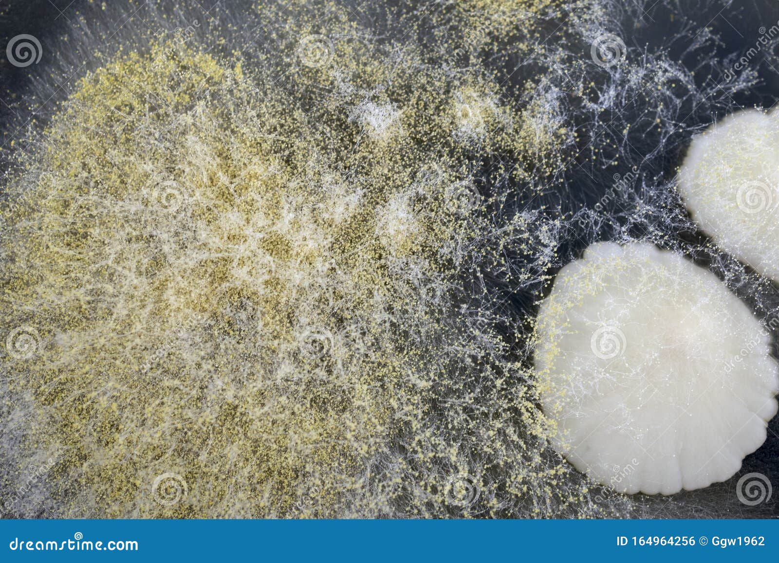 Yeast and mold stock photo. Image of morphology, inspection 164964256