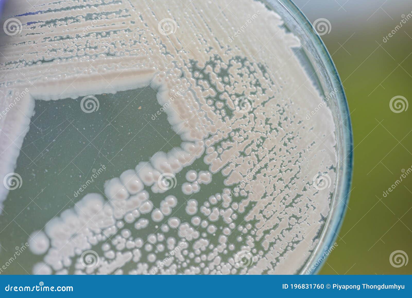 Yeast in Petri Dish for Education in Laboratories. Stock Photo Image