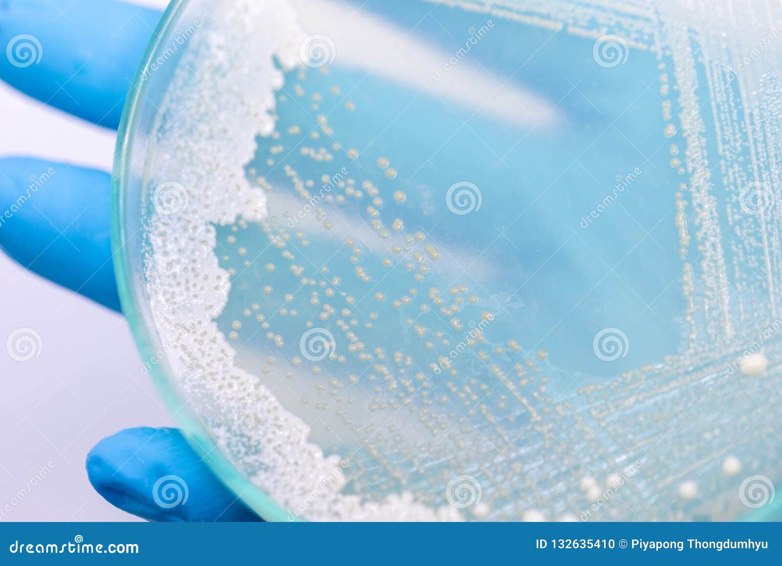 Yeast in Petri Dish, Microbiology for Education. Stock Photo Image of