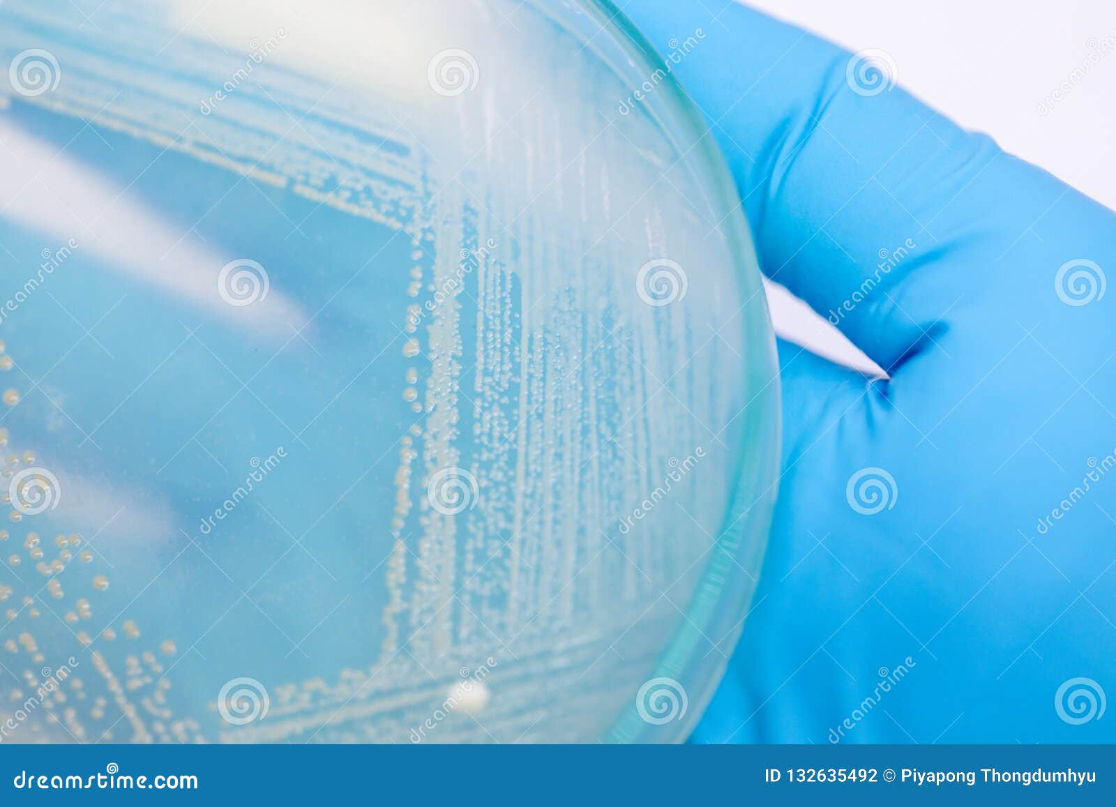 Yeast in Petri Dish, Microbiology for Education. Stock Photo Image of