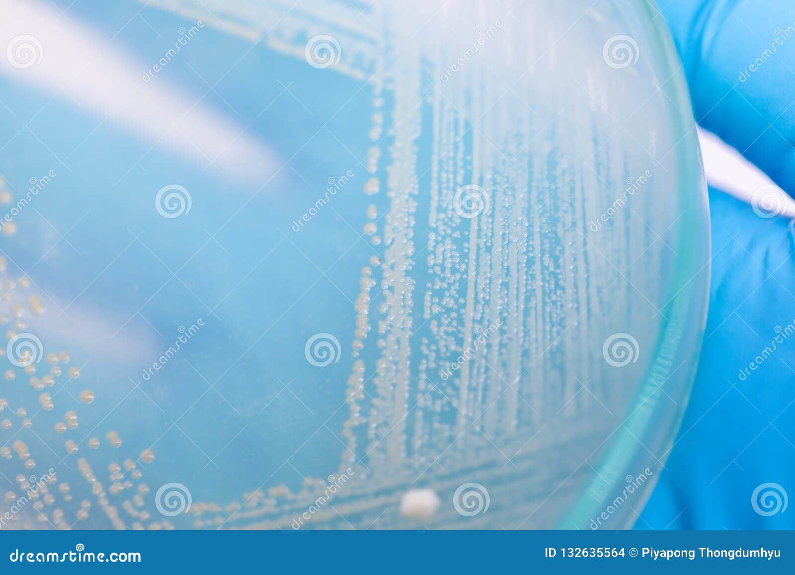 Yeast in Petri Dish, Microbiology for Education. Stock Photo Image of