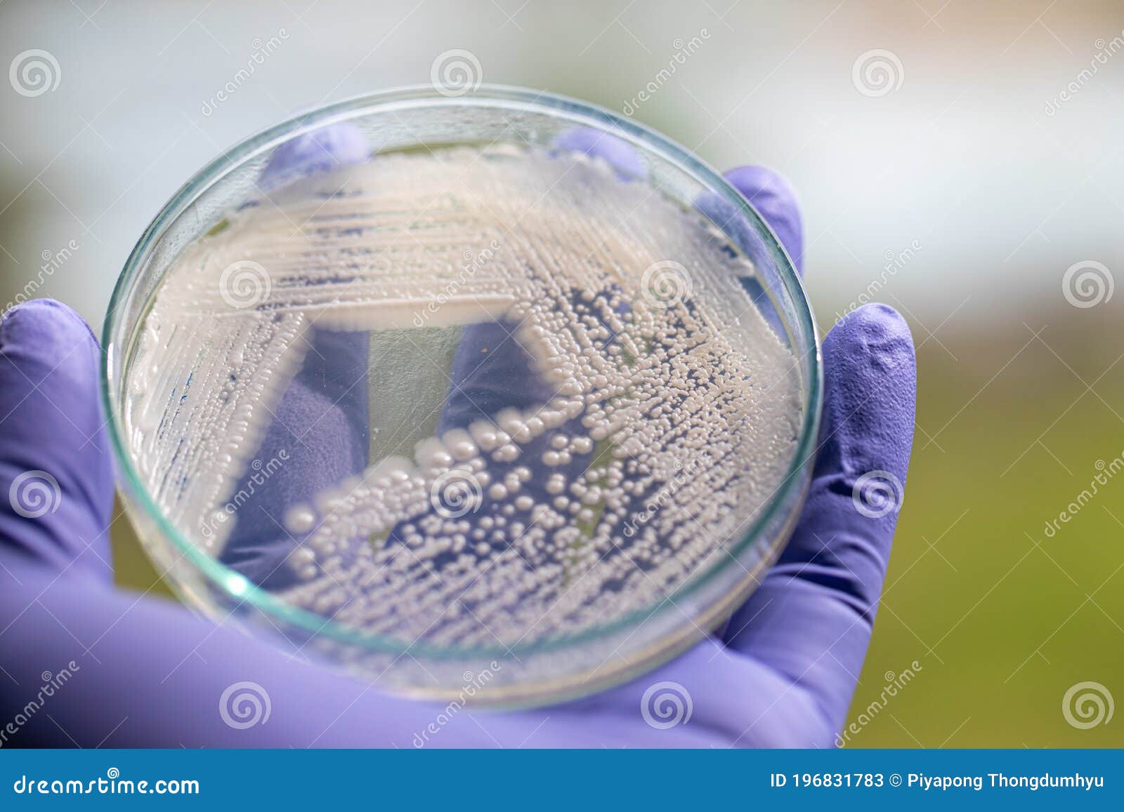 Yeast in Petri Dish for Education in Laboratories. Stock Image Image