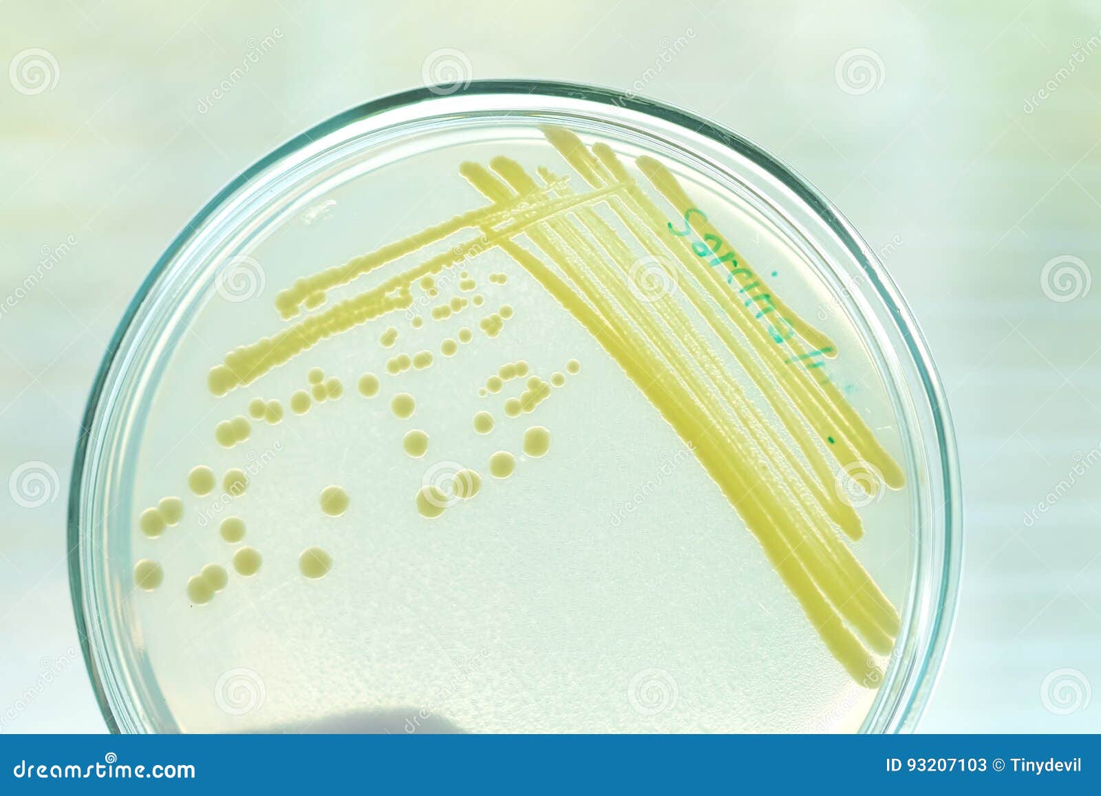 Yellow colony of bacteria stock image. Image of drug 93207103
