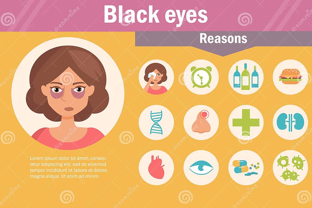 Yeux Au Beurre Noir Raisons Illustration de Vecteur Illustration du fâché, yeux 81841777