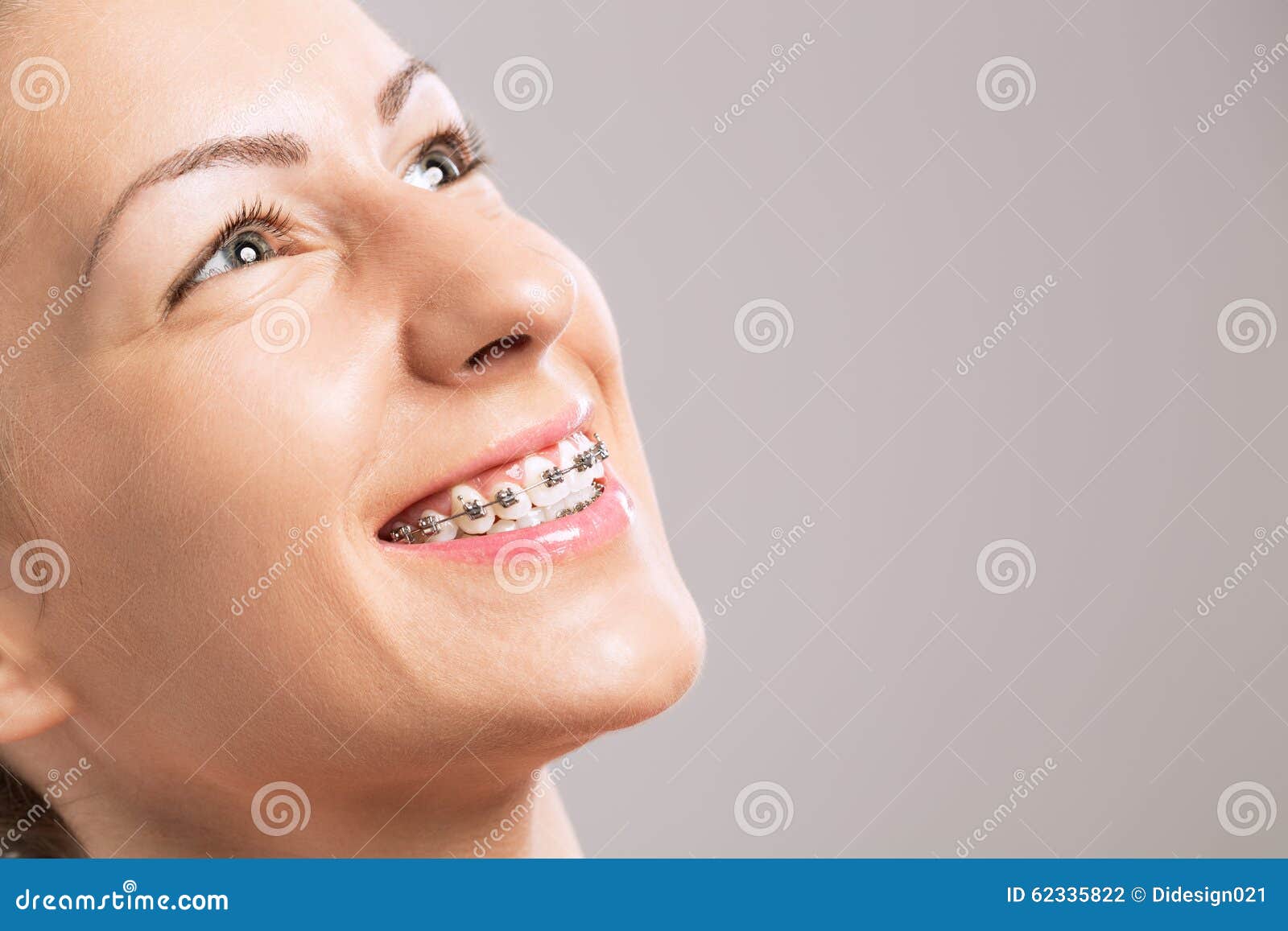 Young Girls With Braces On Teeth