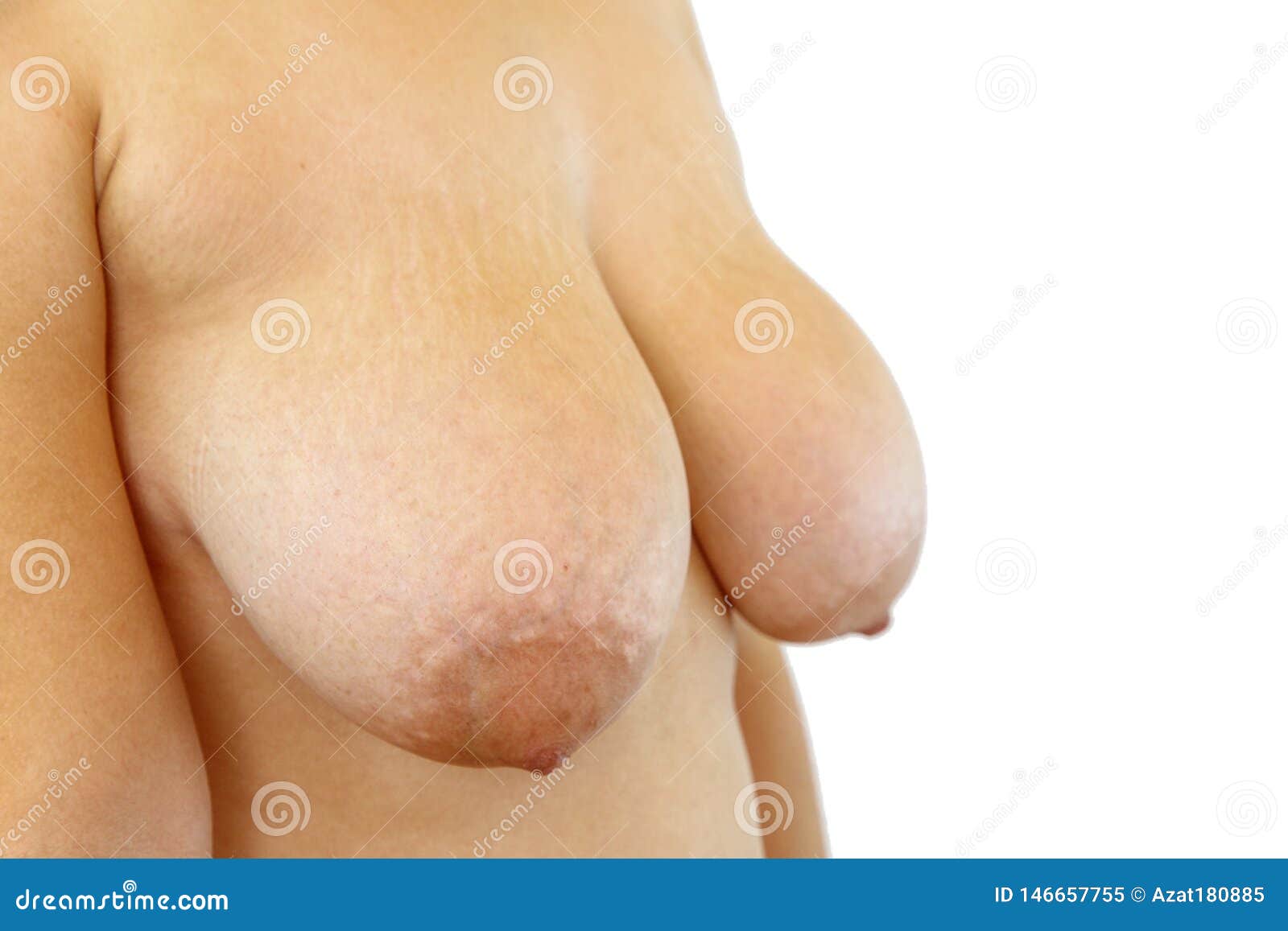 Fat Women Naked Breast