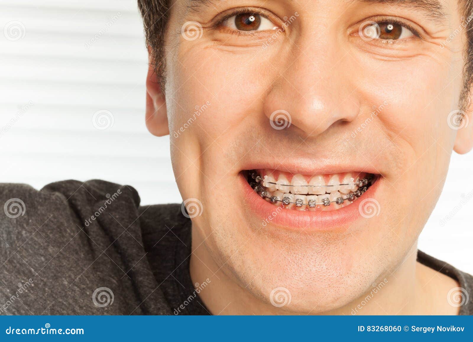 young man with dental braces on his teeth