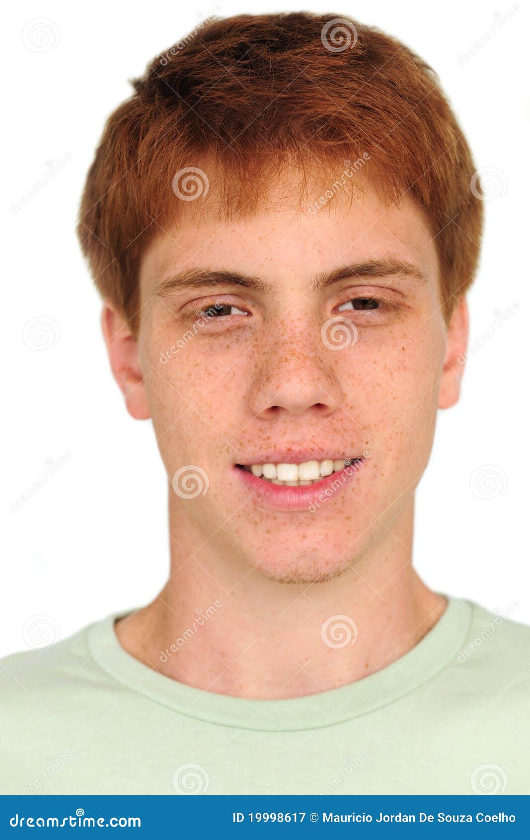 young man with freckles