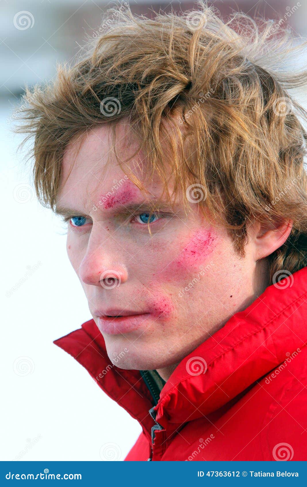 Young Man with Grazes on a Face Stock Photo Image of expression, shot
