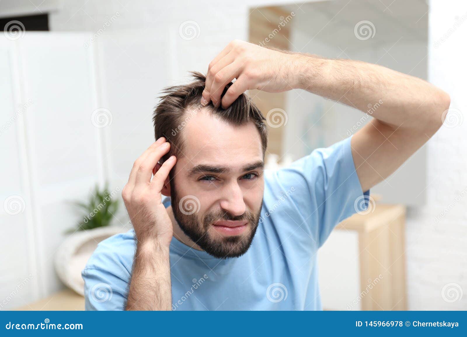 Young Man with Hair Loss Problem Stock Photo Image of bald
