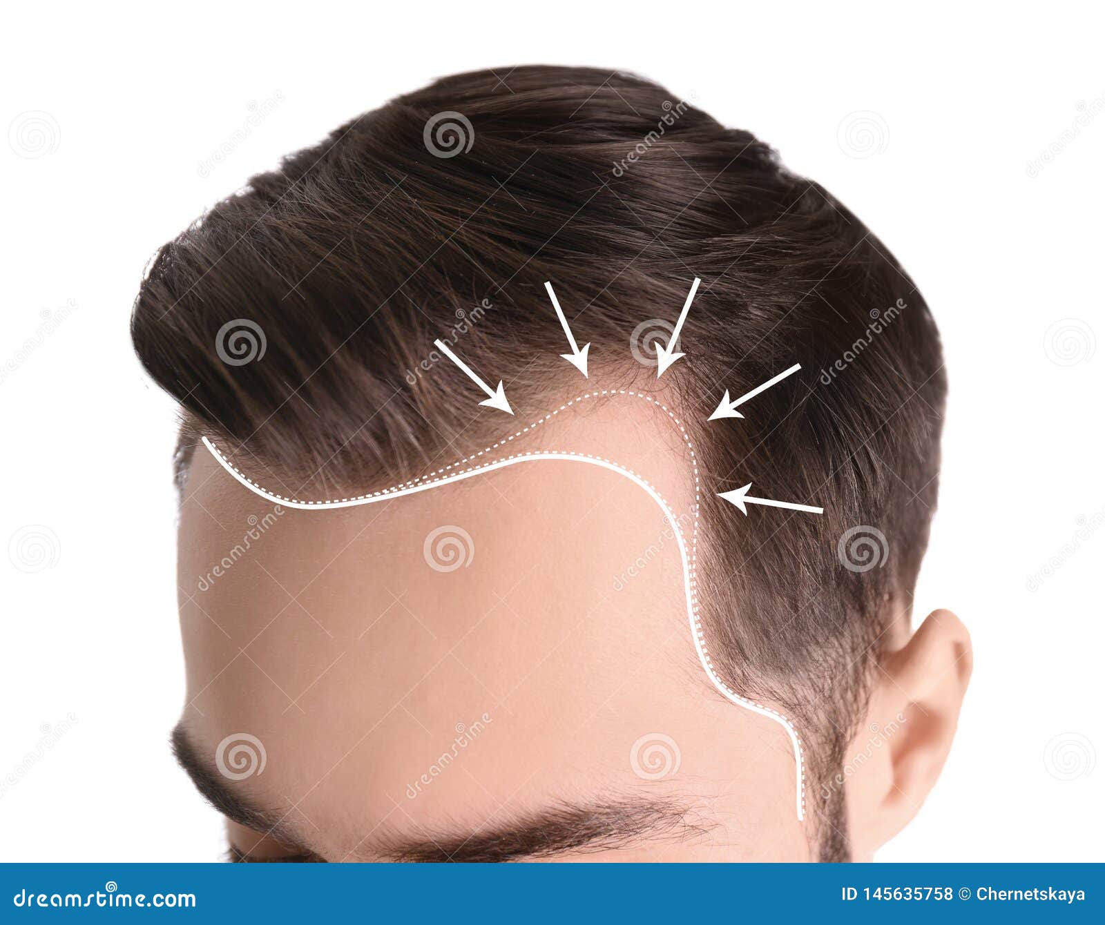 243,019 Man Hair White Background Stock Photos - Free & Royalty-Free Stock Photos from Dreamstime 243,019 Man Hair White Background Stock Photos - Free & Royalty-Free Stock Photos from Dreamstime