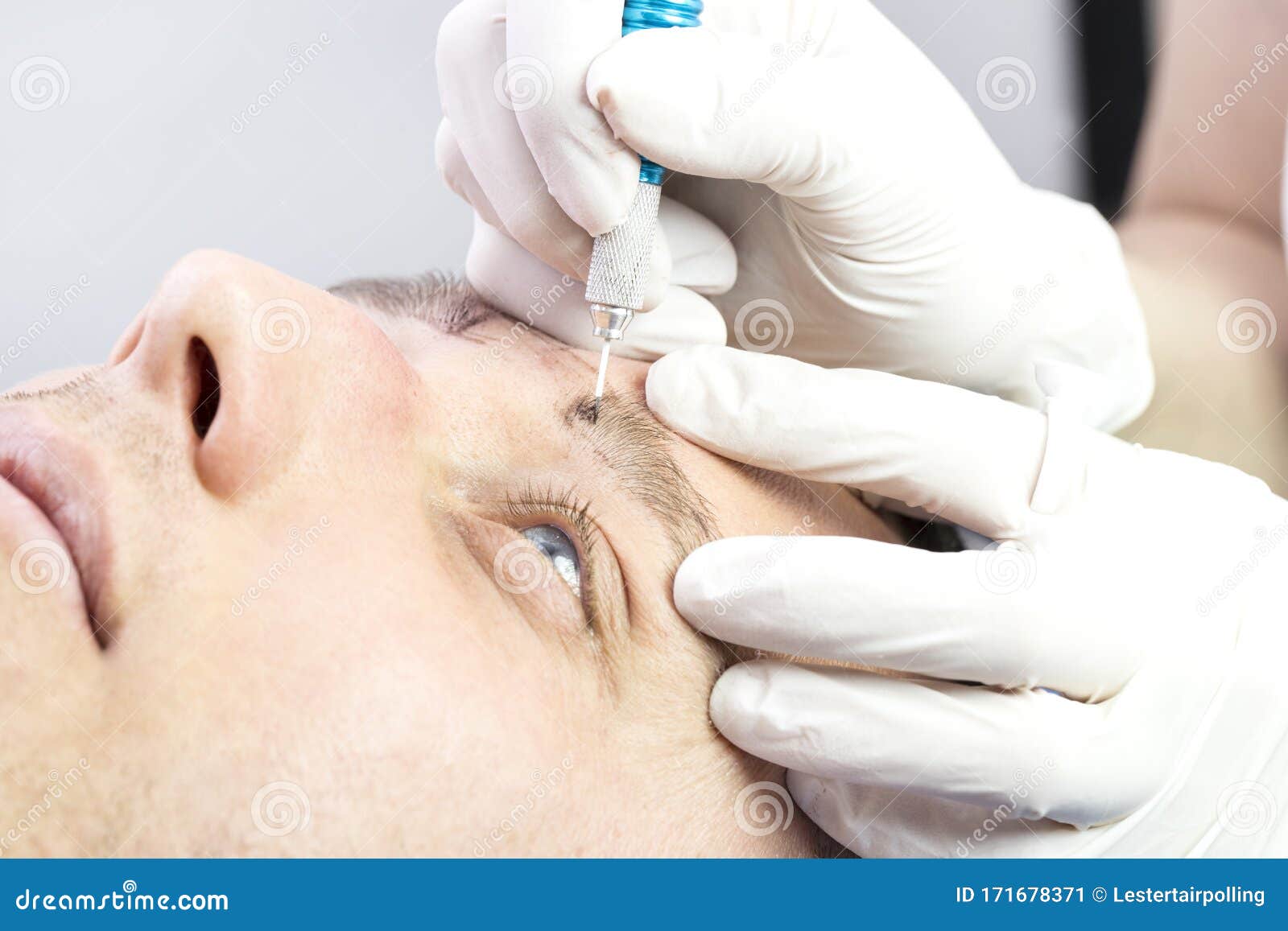 Young Man Microblading Procedure To Improve the Condition of a Mans