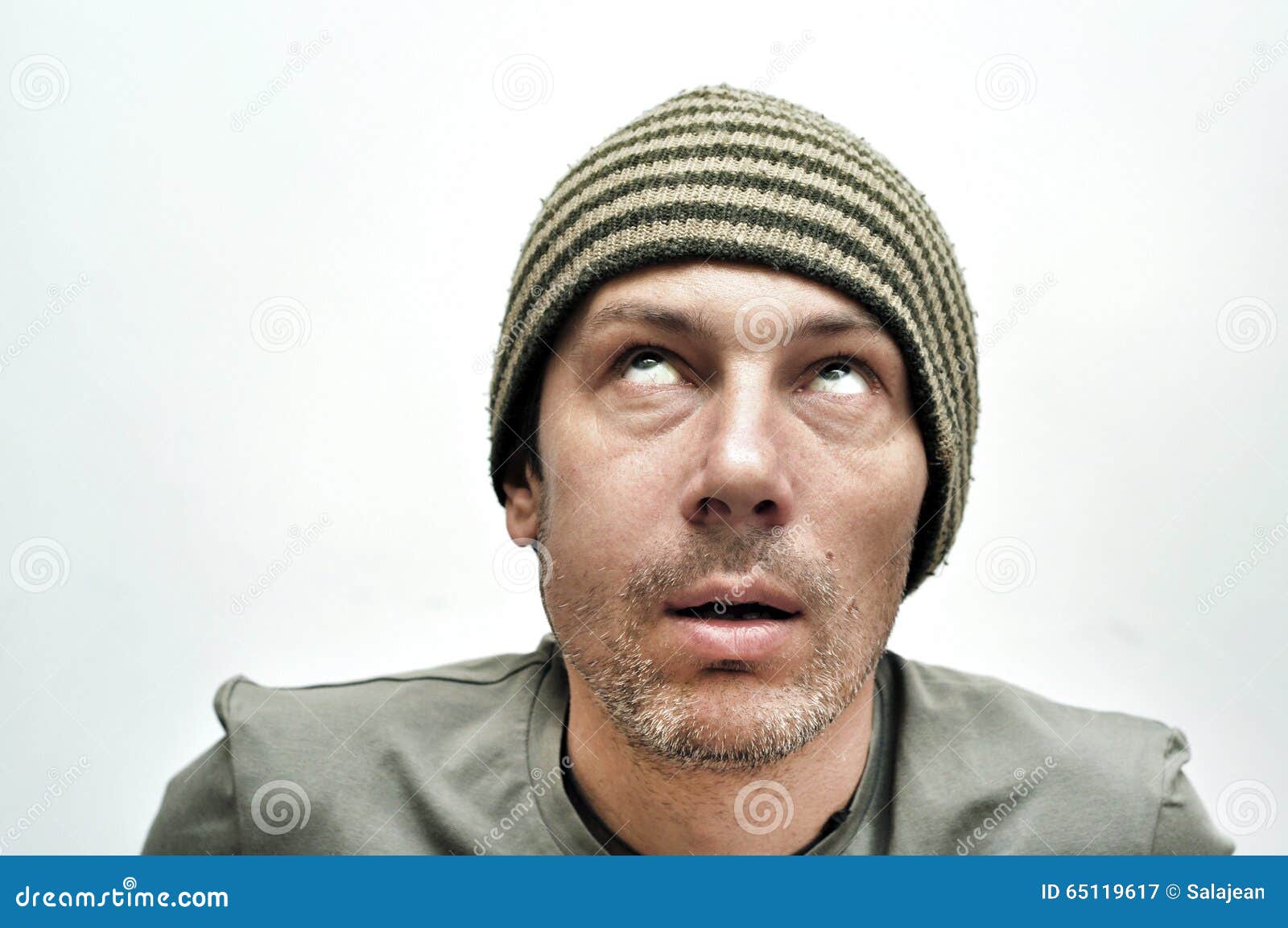 Young Man Suffering from Toothache, Teeth Pain, Swollen Face Stock