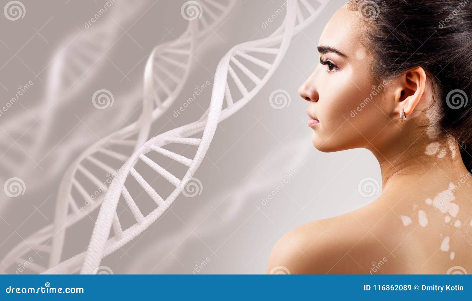 young sensual woman with vitiligo disease in dna chains.