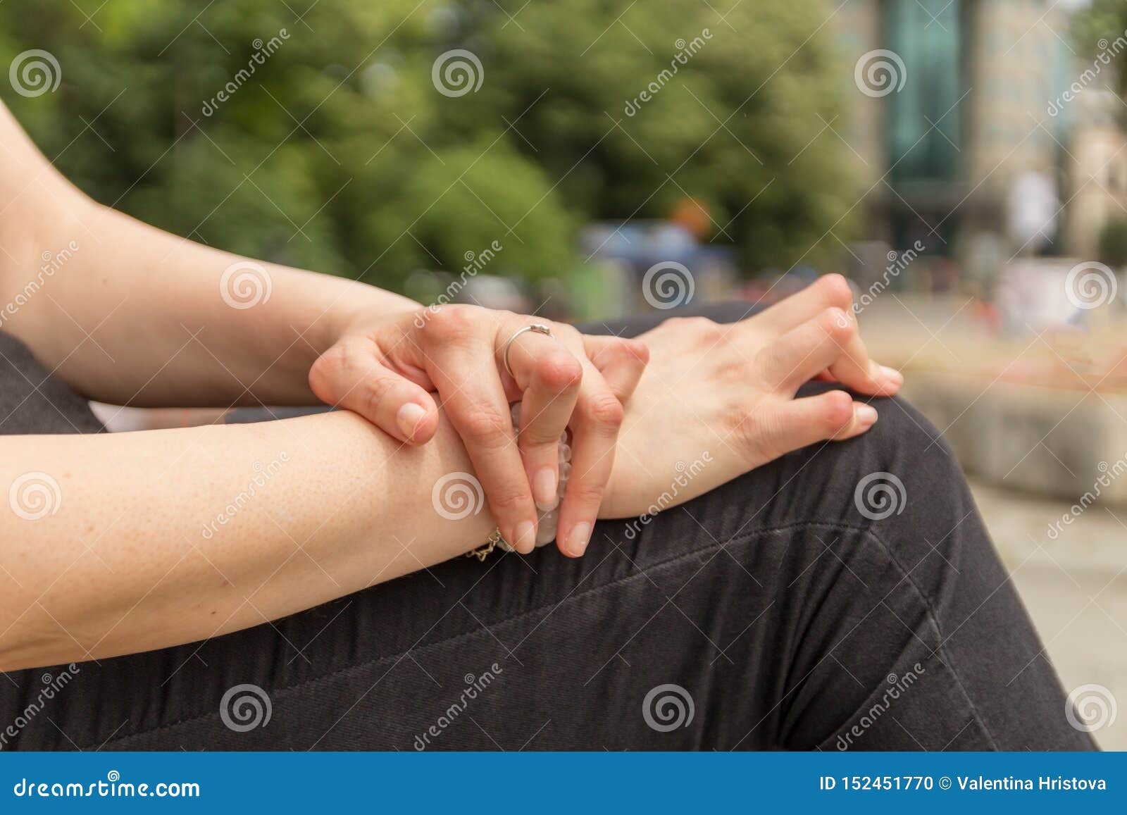 young woman having rheumatoid arthritis takes a rest sitting on a bench at a park. hands and legs are deformed. she feels pain.