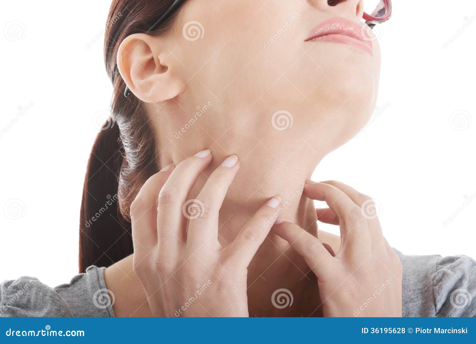 Young Woman is Scratching Her Neck. Stock Photo Image of eczema