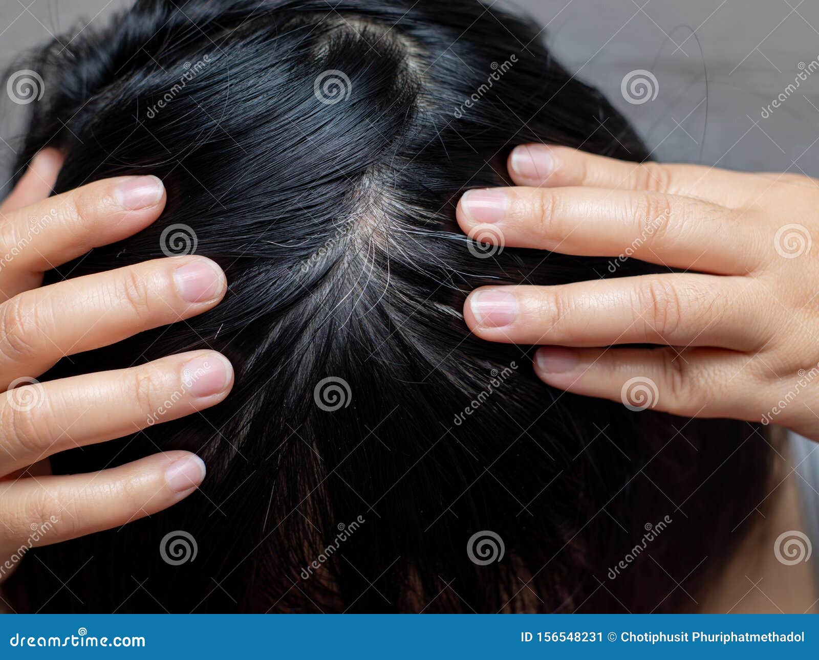 Young Woman Shows Her White Hair Roots Stock Image Image Of Hand Close 156548231